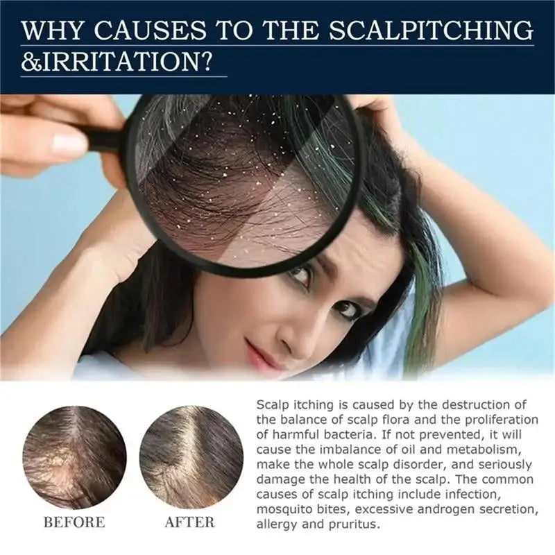 Jelieora Venture scalp exfoliating scrub and treatment cream for hair and scalp care, shown in a sleek jar with product label.
