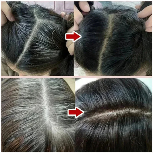 Jelieora Venture 3-in-1 darkening hair color shampoo for hair and scalp care, showing the shampoo bottle with dark liquid inside.