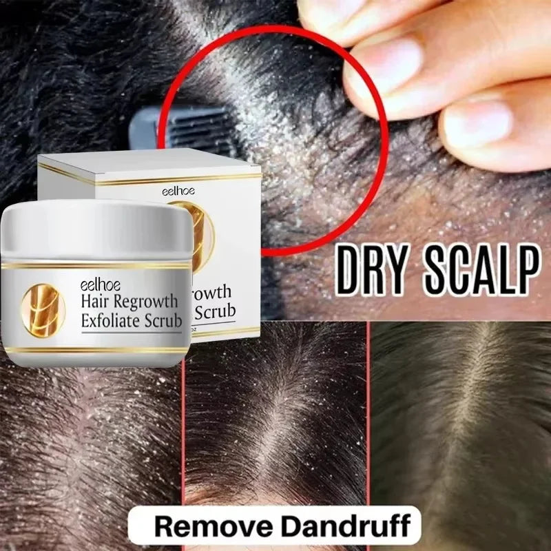 Jelieora Venture scalp exfoliating scrub and treatment cream in a white jar, with textured surface and label visible.