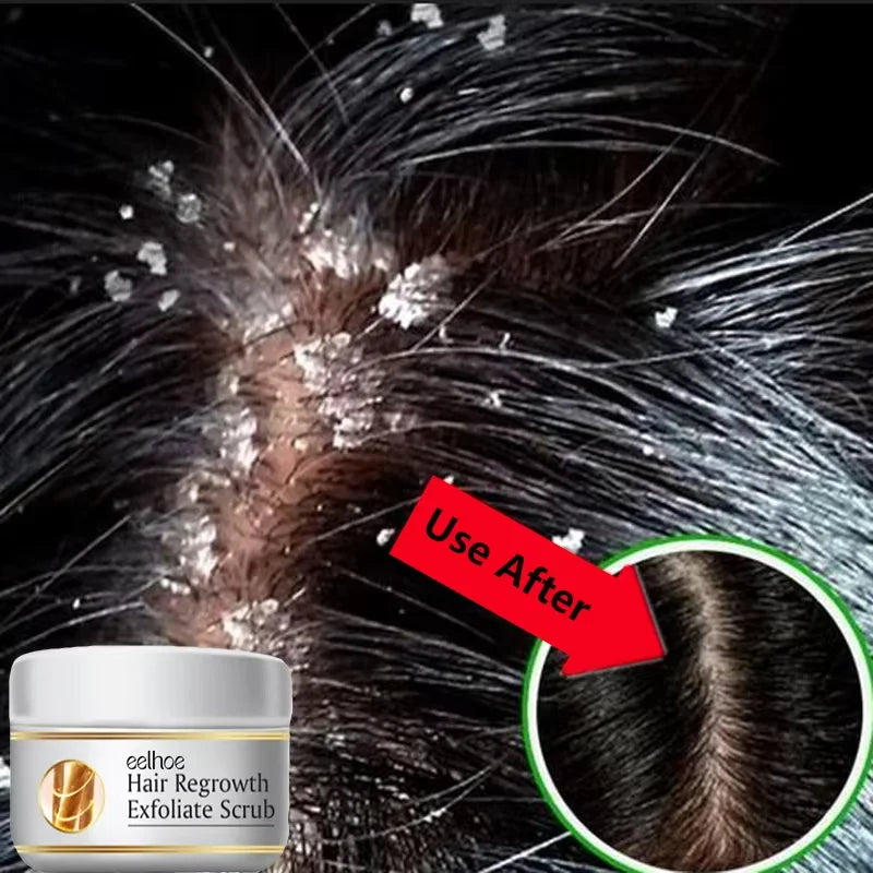 Jelieora Venture scalp exfoliating scrub and treatment cream in a jar, designed for hair and scalp care.