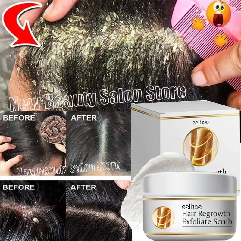 Jelieora Venture Scalp Exfoliating Scrub and Treatment Cream for hair and scalp care, shown in a sleek jar with a creamy texture.