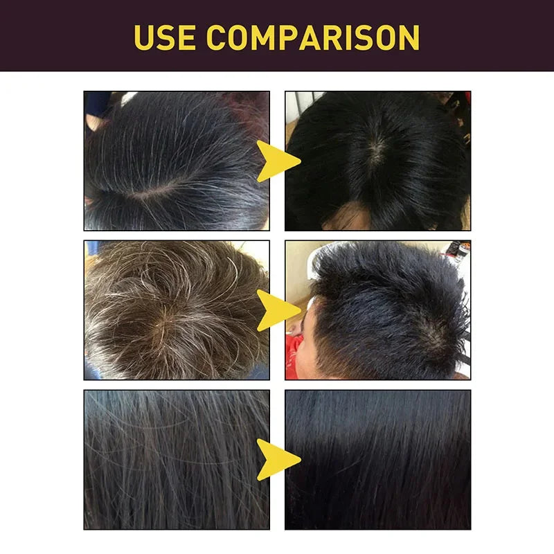 Jelieora Venture 3-in-1 darkening hair color shampoo showing the bottle with dark hair and scalp care features