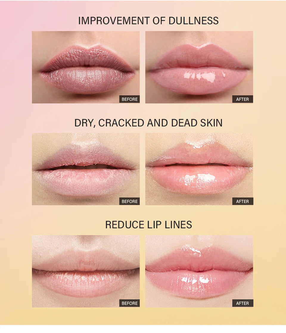 Jelieora Venture Lakerain Peptide Lip Treatment Jelly in 10ml, transparent moisturizing lip balm with plumping and fine line repair.