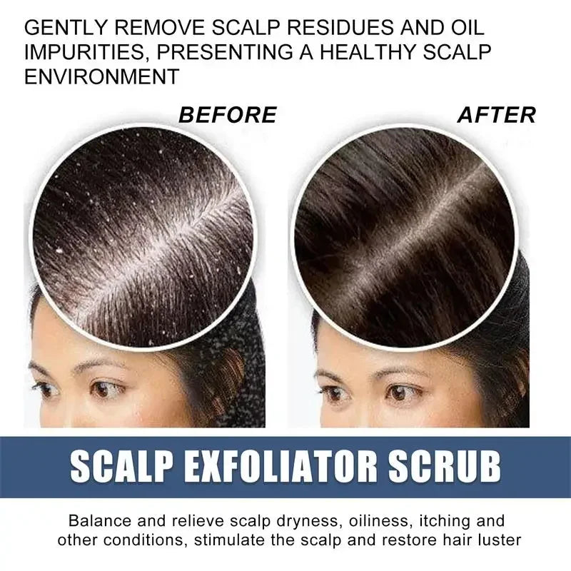 Jelieora Venture scalp exfoliating scrub and treatment cream for hair and scalp care, shown in a sleek jar.